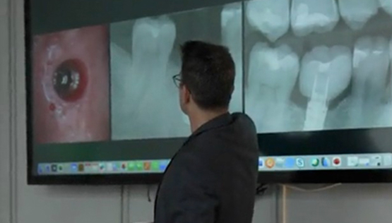 snapshot implant - 04