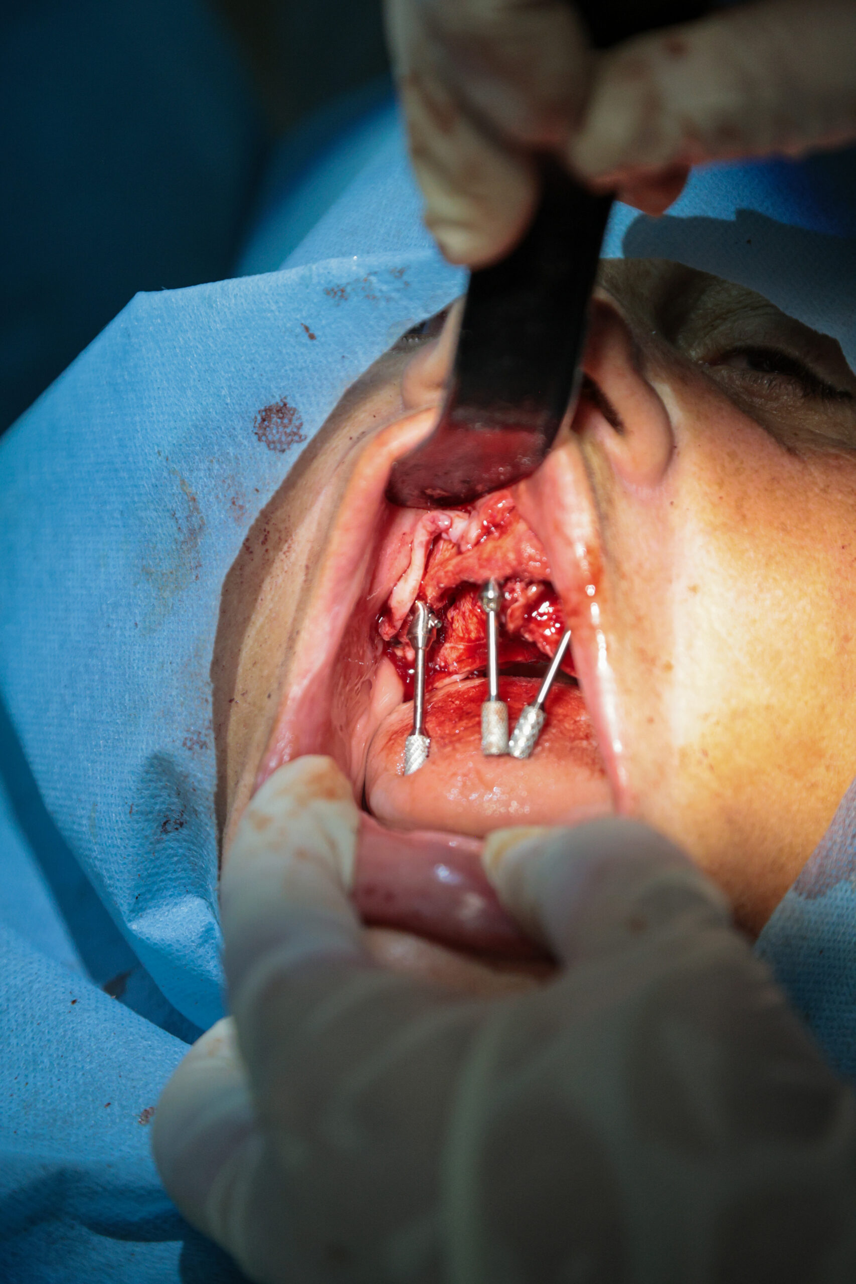 Live patient training at ADI