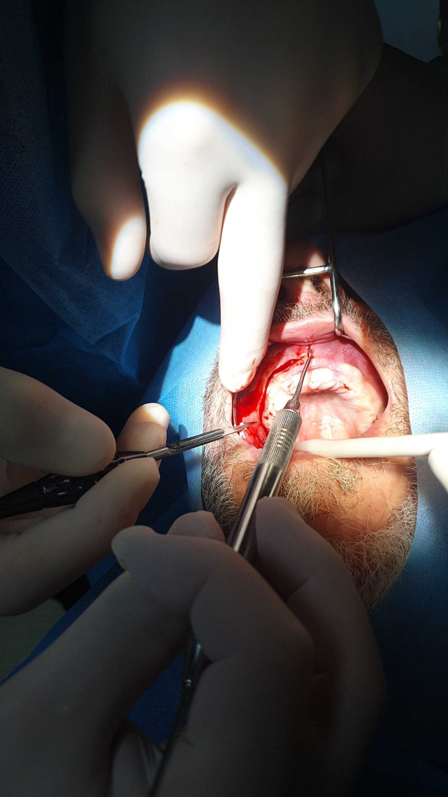 Live patient training at ADI