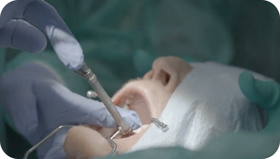 Close-up of a surgical drill performing membrane elevation technique