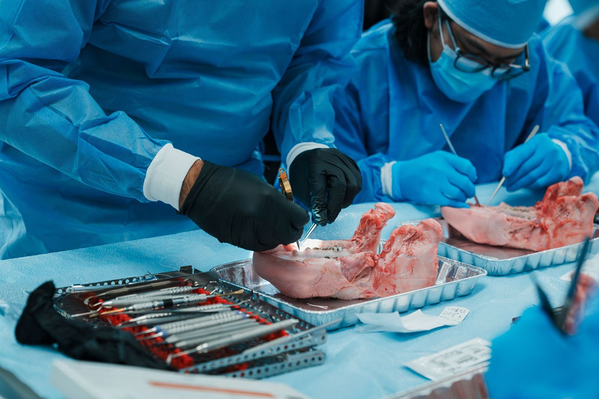 GBR - Guided Bone Regeneration