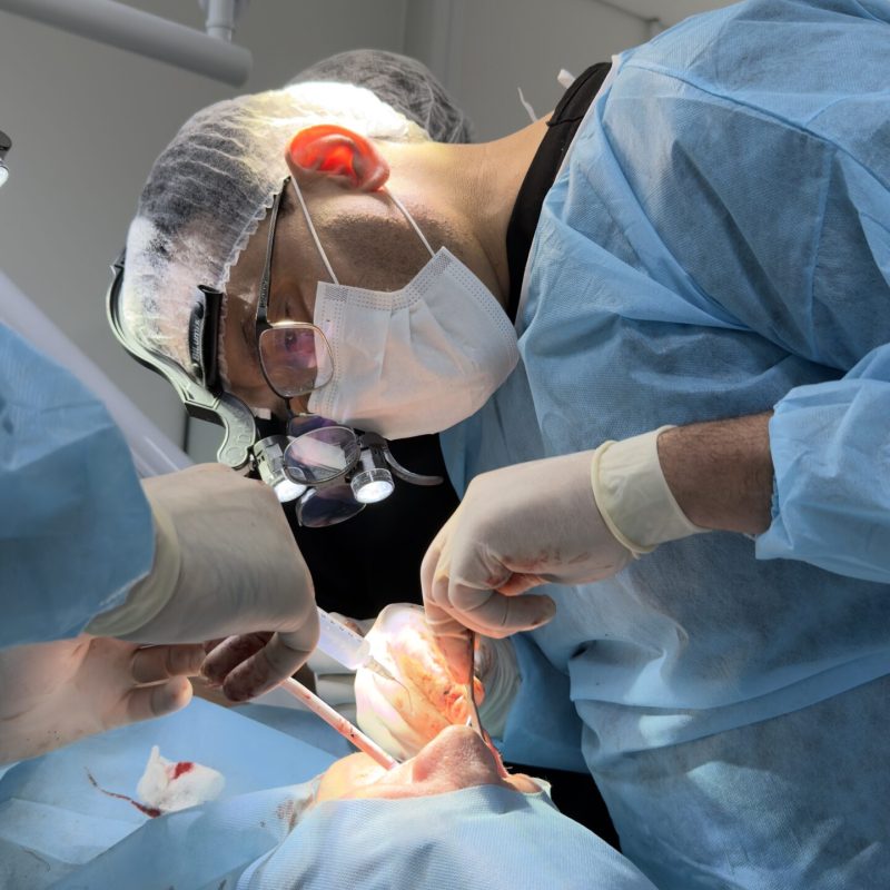 Full Arch Live Patient Training in Brazil - 08